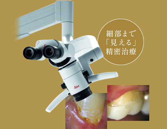 細部まで「見える」精密治療